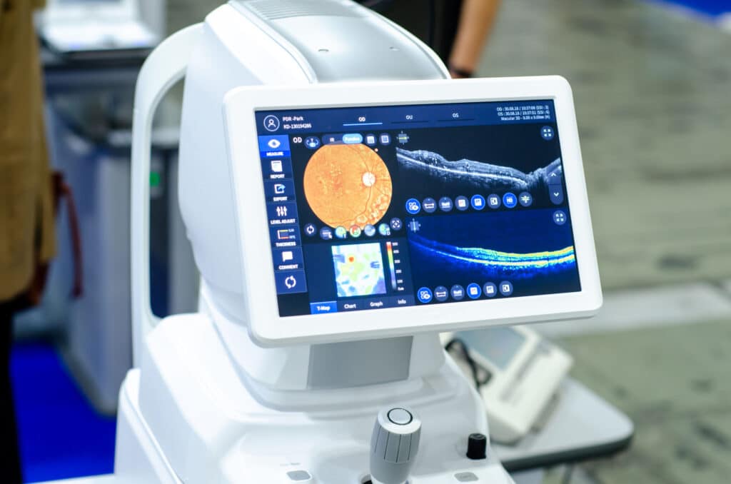 Heidelberg Spectralis 4D OCT Eye Scan machine used for advanced eye tests
